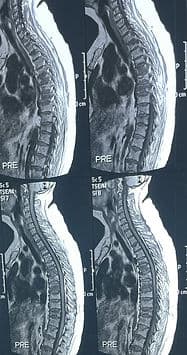 ILBJH Cases image 3