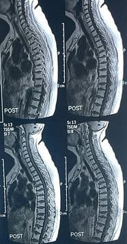 ILBJH Cases image 2